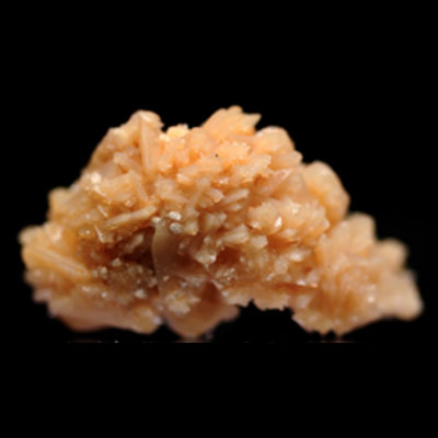 Calcium-Phosphate-Kidney-Stone-different-type-kidney-crystals